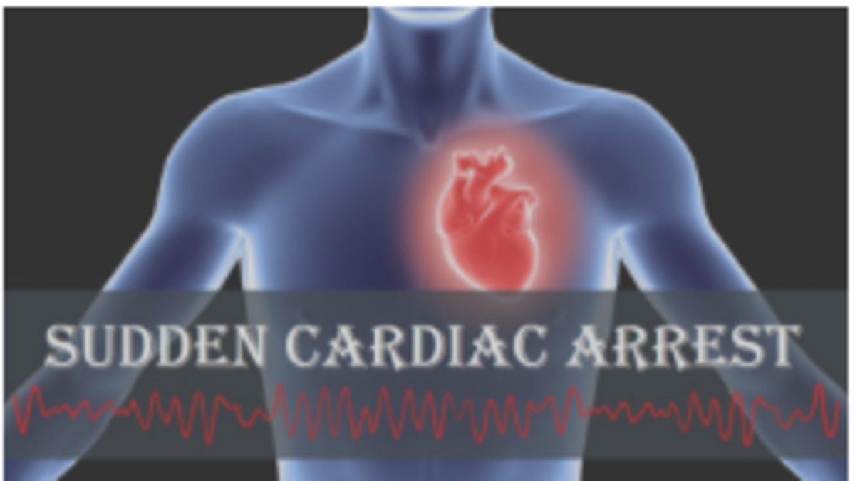 How to recognise and respond to a sudden cardiac arrest