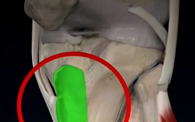 Osgood Schlatters Disease/ Knee Injury – Know the facts